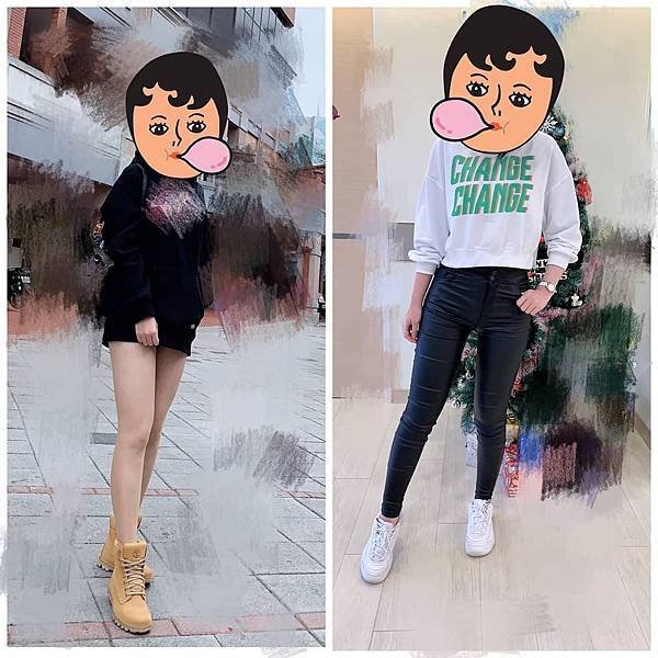 大腿抽脂術後的效果紀錄