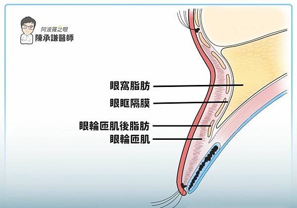 老化型的眼窩凹陷，脂肪流失是其中一項主要原因