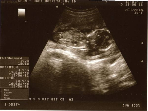20120103.jpg