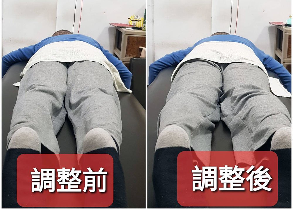 台南整骨｜元強健康手護會館｜仙骨微調調整尾椎｜正確坐姿站姿