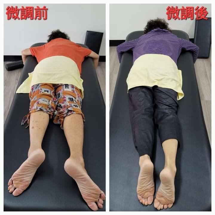 台南整骨推薦│元強專業仙骨微調│長短腳、骨盆歪斜不再是困擾│