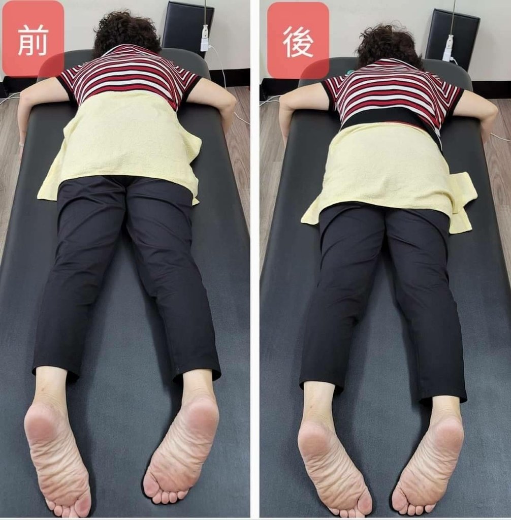 台南整骨推薦│元強專業仙骨微調│長短腳、骨盆歪斜不再是困擾│
