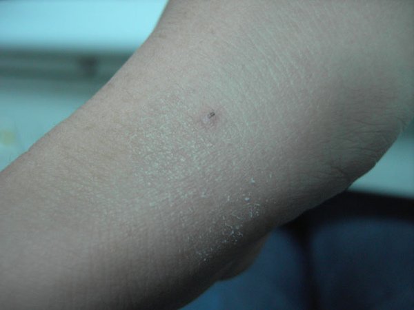 PICT5987.JPG