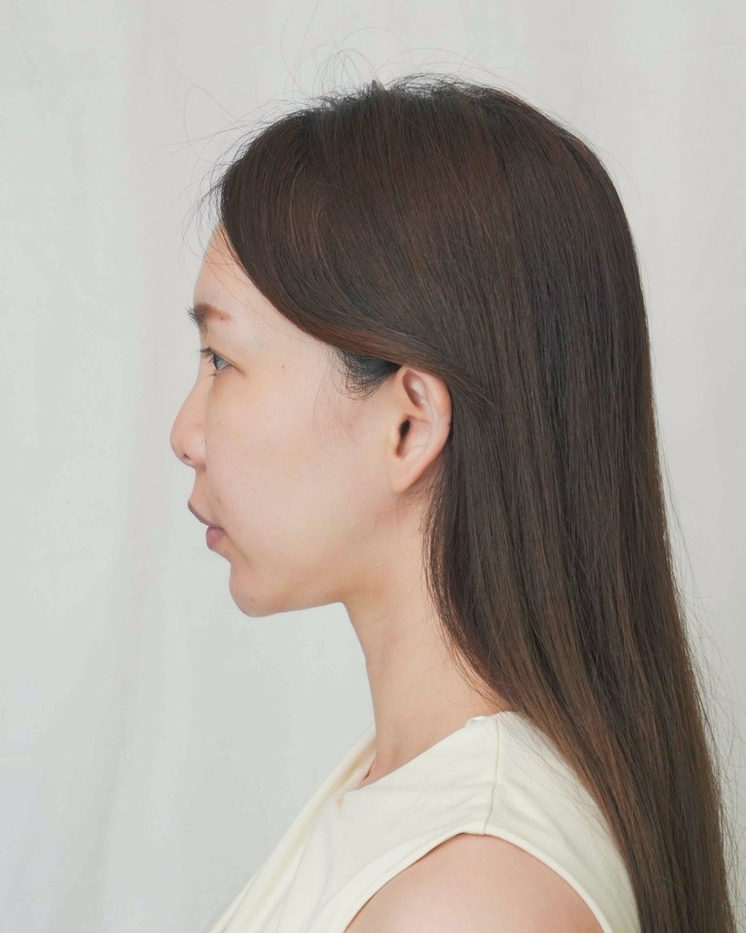 變身濃顏系美人 偷偷變漂亮秘密-美麗風尚醫學美容診所 無痕鼻