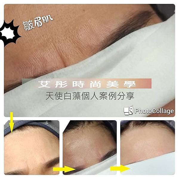 很多人問...白藻是甚麼?2