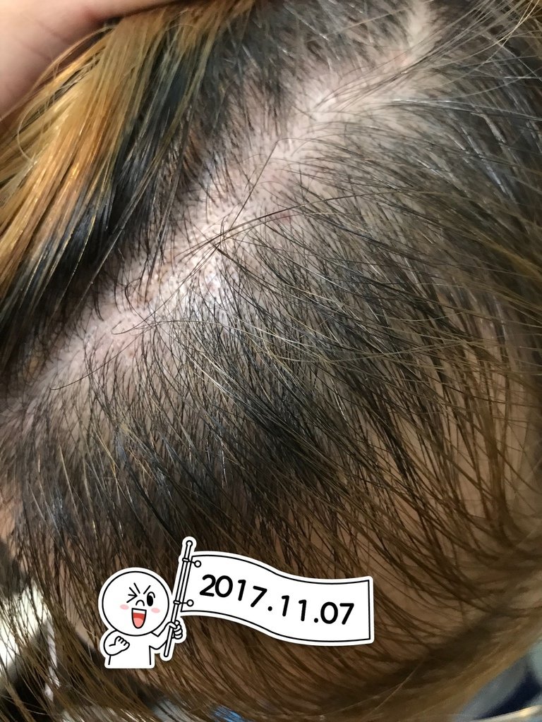 2017110701.jpg