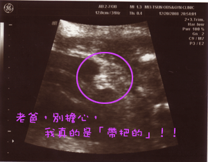 邦邦的超音波照片05.gif