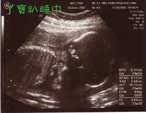 邦邦的超音波照片06.gif