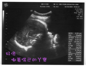 邦邦的超音波照片09.gif