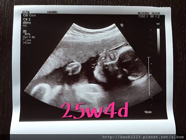 25w4d