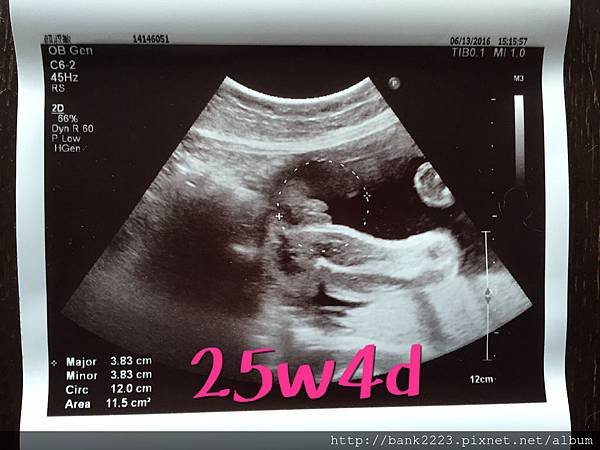 25w4d