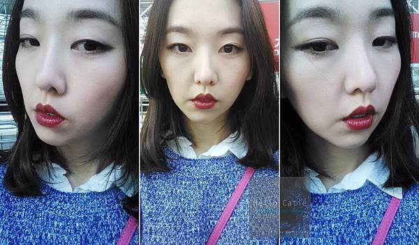 【美之約成功案例】[醫美] 立即有感的超強小臉效果 晶亮瓷(