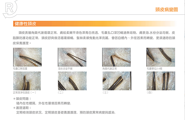 髮基因｜健康的頭皮是油水平衡有光澤.png
