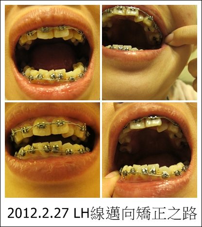 20120227