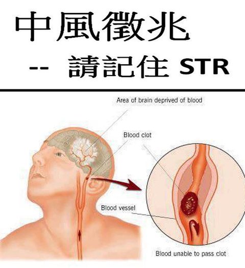 中風癥兆