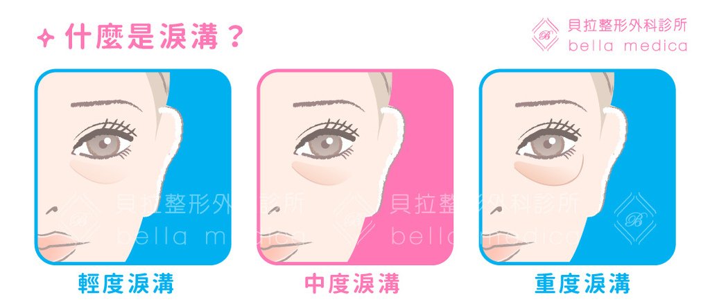 工作區域 2 複本 4-100.jpg