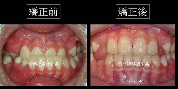 投影片8.JPG