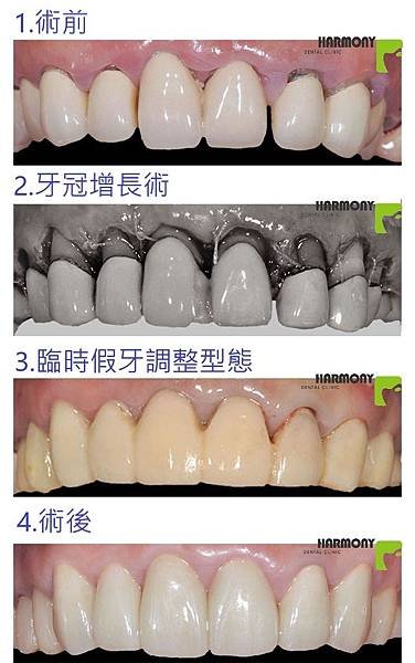 clp比較.jpg