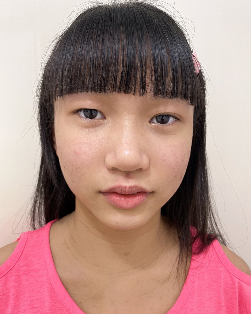 有感淨痘精華液11.jpg