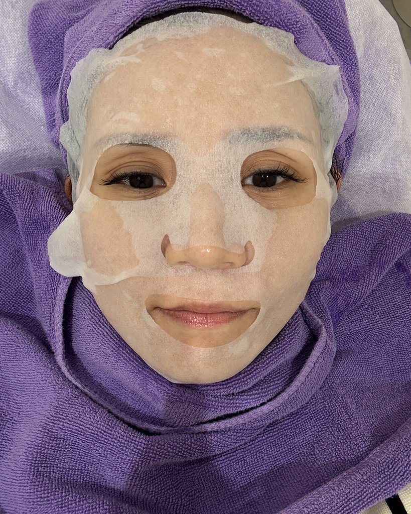 愛爾麗診所- HIPRO-S龍捲風音波拉提18.jpg