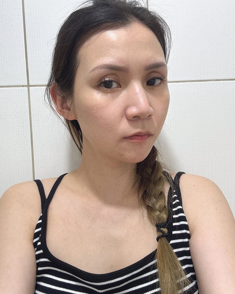 愛爾麗診所- HIPRO-S龍捲風音波拉提20.jpg