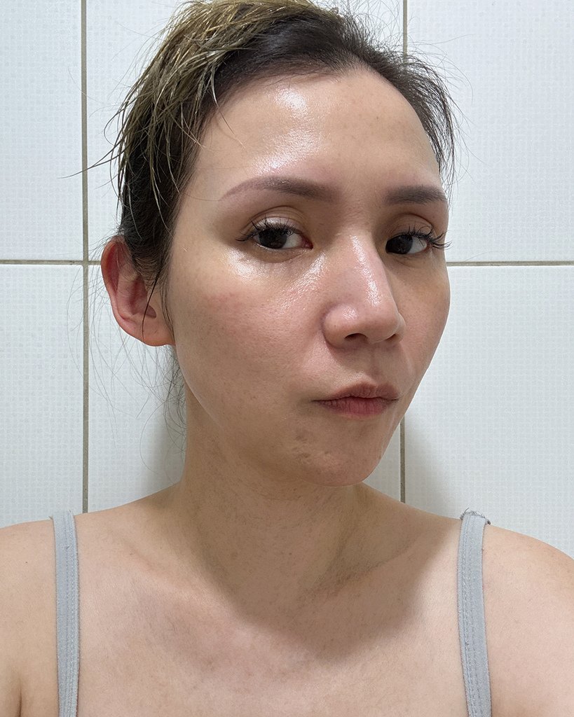 愛爾麗診所- HIPRO-S龍捲風音波拉提21.jpg