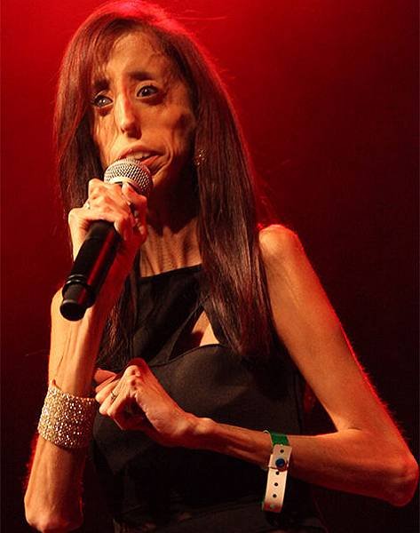 lizzie_velasquez_19crjpr-19crjqi.jpg