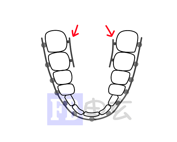 牙齒側面.png