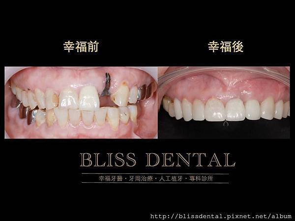 blissdental