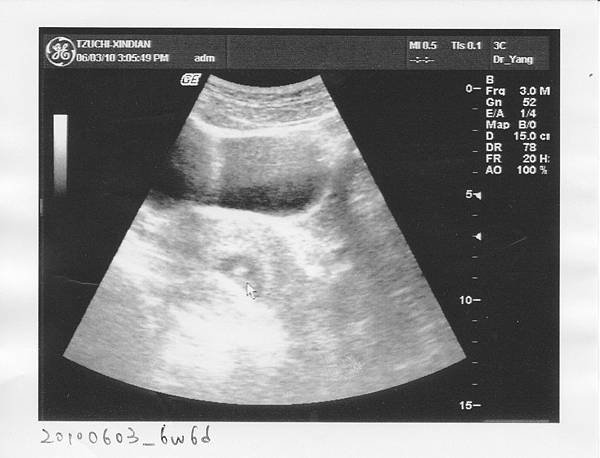 6w6d