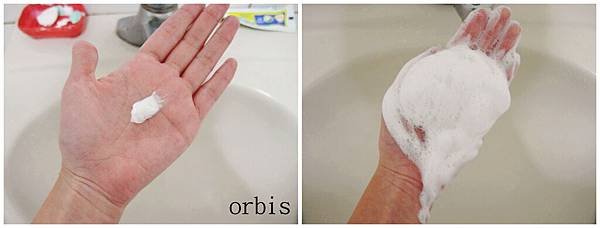 ORBIS