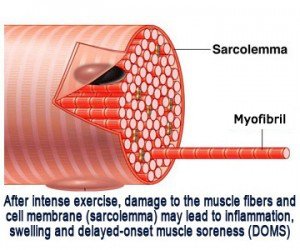 muscle-cell-DOMS-300x250