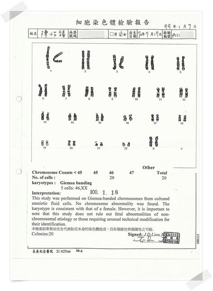 羊膜穿刺報告-1.jpg