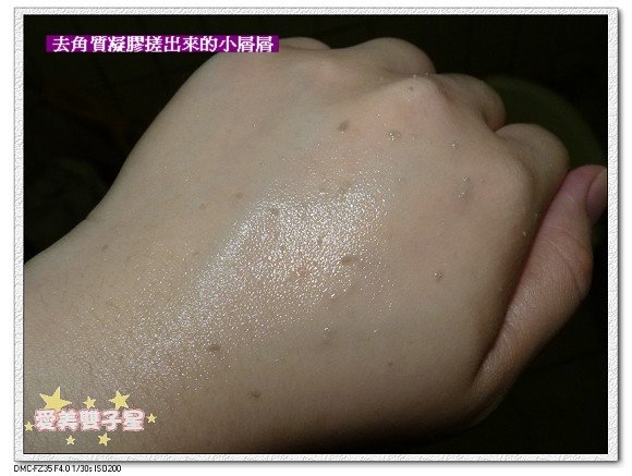 去角質05.jpg
