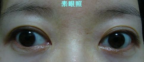 雙眼皮膠條04.jpg