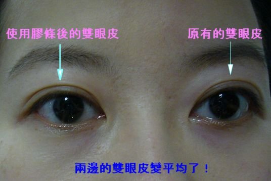雙眼皮膠條07.jpg