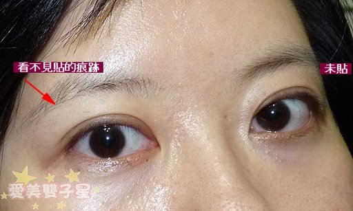 BN雙眼皮貼09.jpg