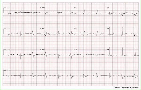  ECG 002 fix.jpg
