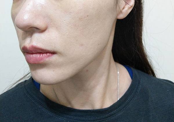 OLAY微磁導入透白面膜精華 微磁導入儀 光塑淡斑精華使用前 (2).jpg