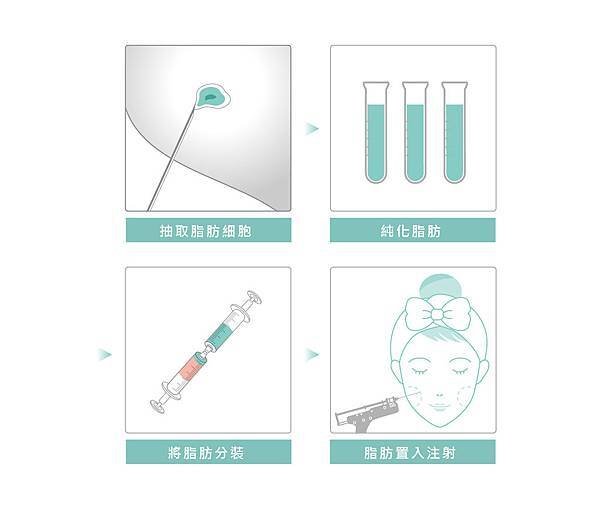 自體脂肪補臉 (2).jpg
