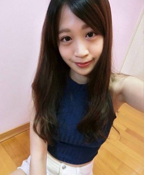 補脂術前_181211_0003.jpg