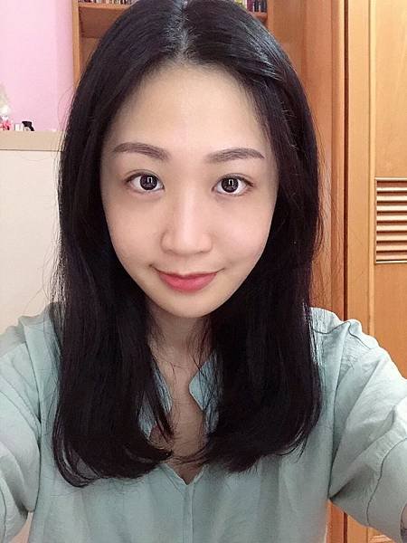 補脂術後_181211_0001.jpg
