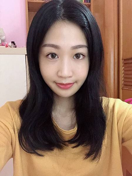 補脂術後_181211_0006.jpg