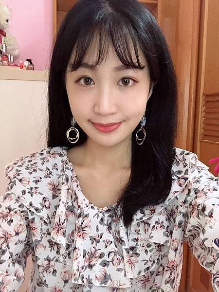 補脂術後_181211_0003.jpg