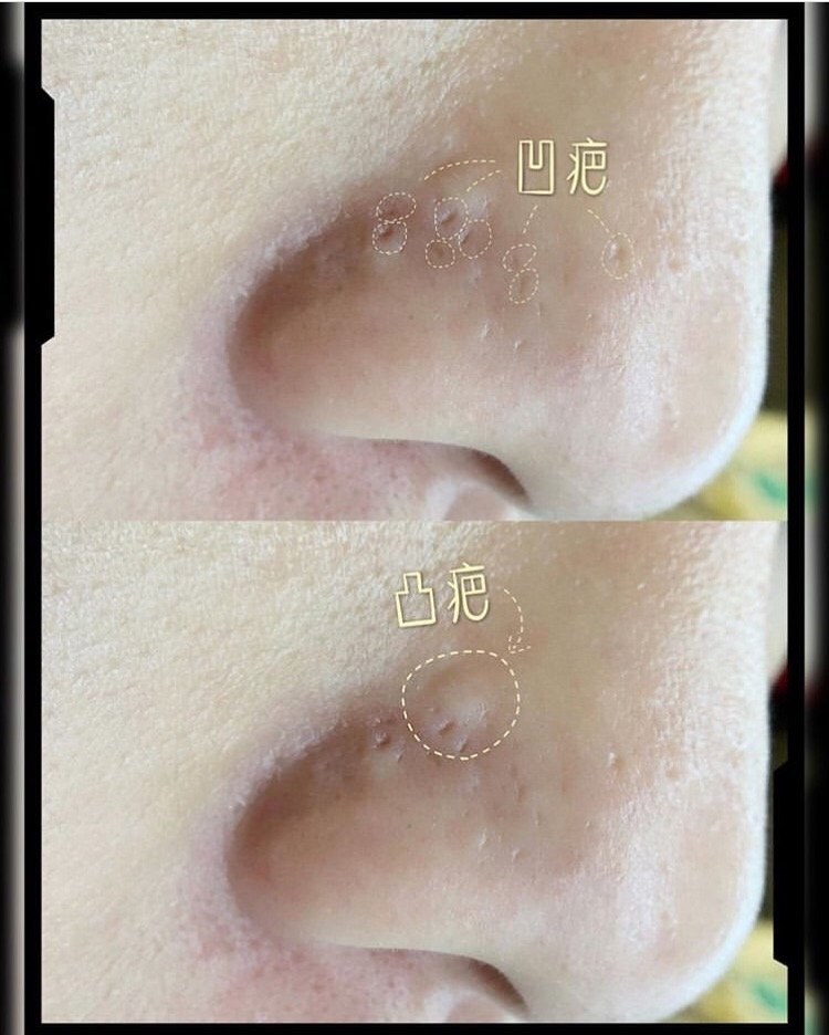 S__187236360.jpg
