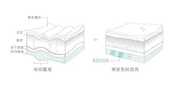 Botex.jpg