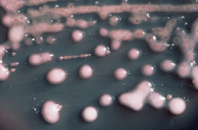 220px-Klebsiella_pneumoniae_01.png