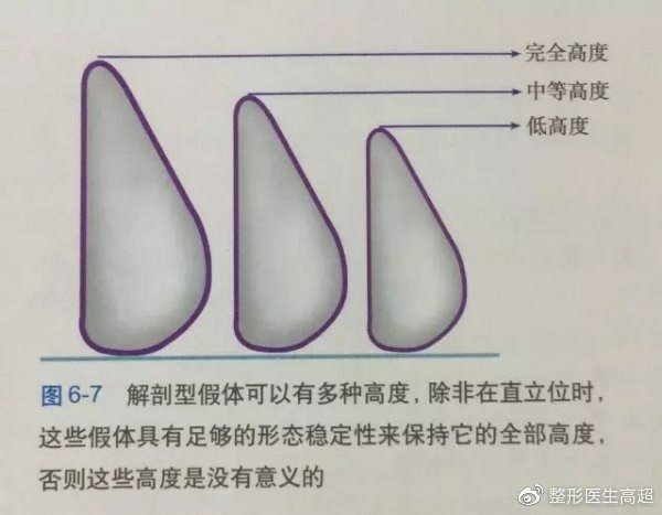 台中隆乳費用