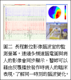 長程數位影像腦波室的監測螢幕。連續多頻道腦電圖與病人的影像會同步顯示，醫師可以藉由反覆播放發作時病人的臨床表現，了解同一時刻的腦波變化。