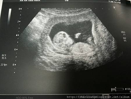 2014-08-15 11.09.35